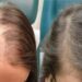 Типы волос у блондинок и брюнеток